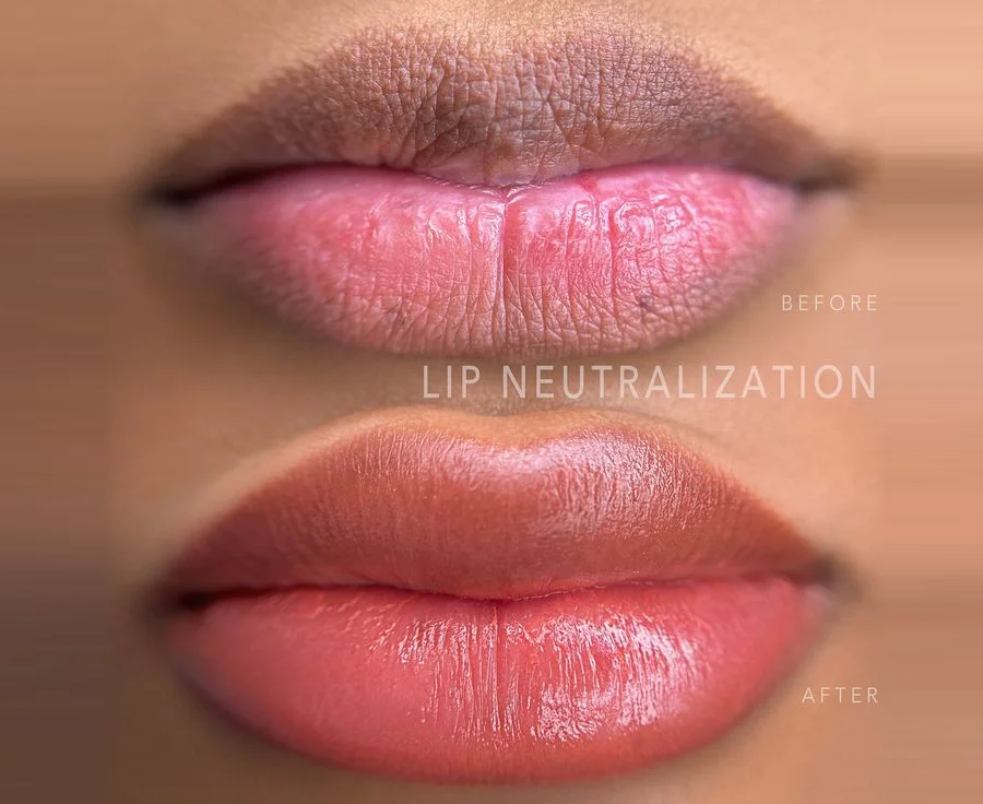 What Is Lip Neutralization in Permanent Makeup (PMU)? A Complete Guide